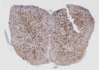ミクログリアを染色したマウスの脊髄